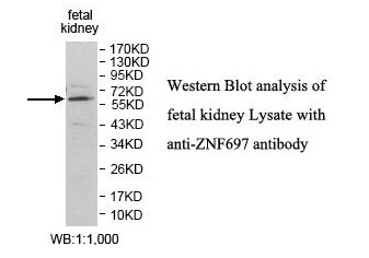 Anti-ZNF697 Antibody Anti-ZNF697 Antibody