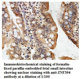 Anti-ZNF394 Antibody