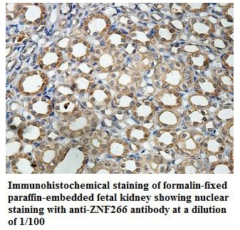 Anti-ZNF266 Antibody