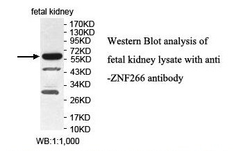 Anti-ZNF266 Antibody Anti-ZNF266 Antibody