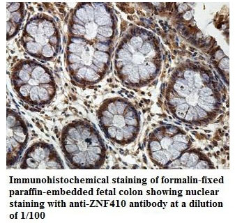Anti-ZNF410 Antibody