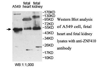 Anti-ZNF410 Antibody Anti-ZNF410 Antibody