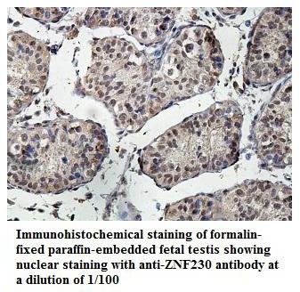 Anti-ZNF230 Antibody