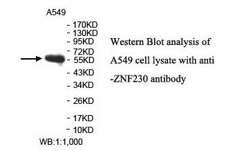 Anti-ZNF230 Antibody Anti-ZNF230 Antibody