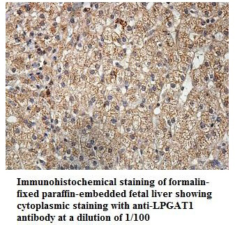 Anti-LPGAT1 Antibody