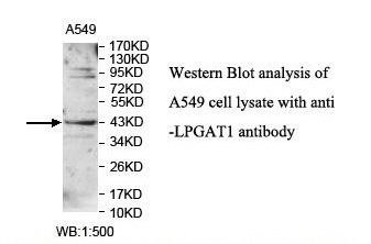 Anti-LPGAT1 Antibody Anti-LPGAT1 Antibody