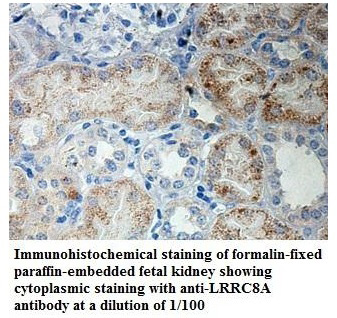 Anti-LRRC8A Antibody