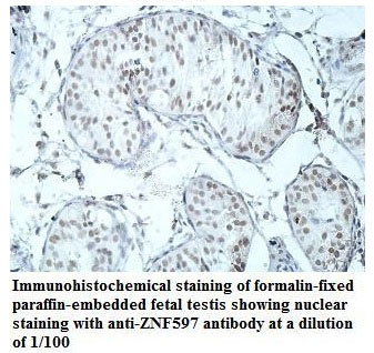 Anti-ZNF597 Antibody