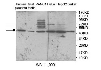 Anti-ZNF597 Antibody Anti-ZNF597 Antibody