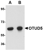 Anti-OTUD5 Antibody
