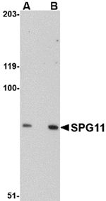 Anti-SPG11 Antibody