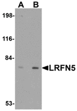 Anti-LRFN5 Antibody