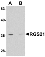 Anti-RGS21 Antibody
