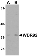 Anti-WDR92 Antibody