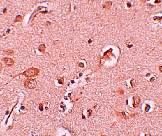 Anti-STAU1 Antibody Anti-STAU1 Antibody