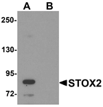 Anti-STOX2 Antibody