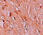 Anti-ZBTB3 Antibody Anti-ZBTB3 Antibody
