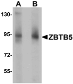 Anti-ZBTB5 Antibody
