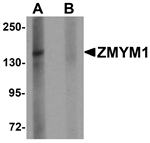 Anti-ZMYM1 Antibody
