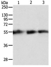 Anti-TEKT5 Antibody