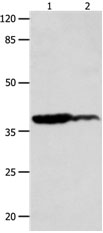 Anti-LPAR4 Antibody