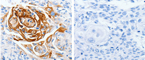 Anti-LPAR4 Antibody Anti-LPAR4 Antibody