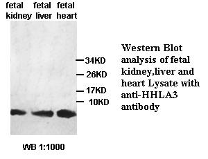 Anti-HHLA3 Antibody Anti-HHLA3 Antibody