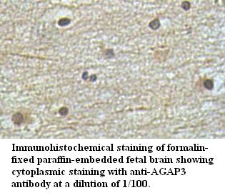 Anti-AGAP3 Antibody
