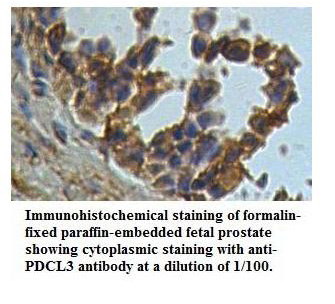 Anti-PDCL3 Antibody