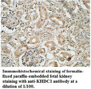 Anti-KHDC1 Antibody