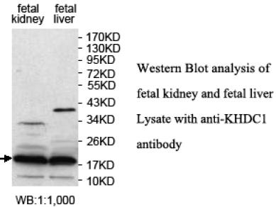 Anti-KHDC1 Antibody Anti-KHDC1 Antibody