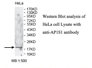 Anti-AP1S1 Antibody Anti-AP1S1 Antibody