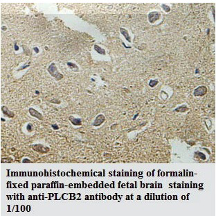 Anti-PLCB2 Antibody