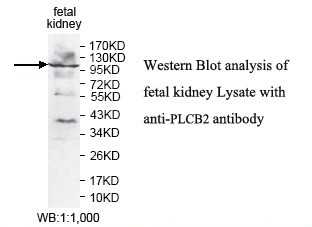 Anti-PLCB2 Antibody Anti-PLCB2 Antibody