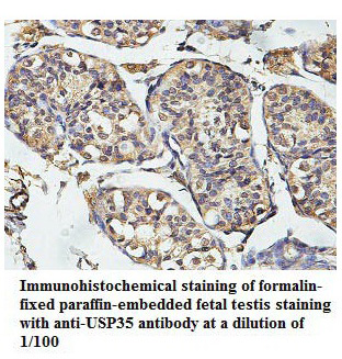 Anti-USP35 Antibody