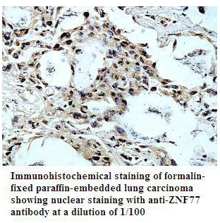 Anti-ZNF77 Antibody