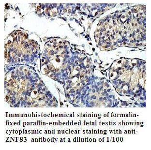 Anti-ZNF83 Antibody