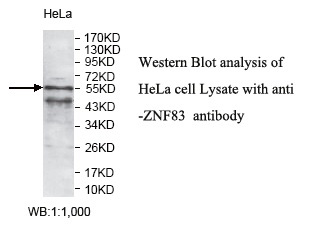 Anti-ZNF83 Antibody Anti-ZNF83 Antibody