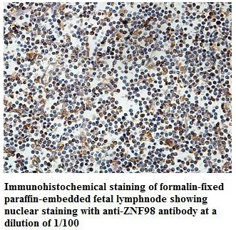 Anti-ZNF98 Antibody