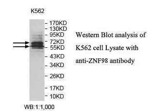 Anti-ZNF98 Antibody Anti-ZNF98 Antibody