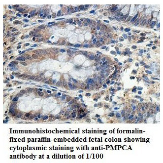 Anti-PMPCA Antibody