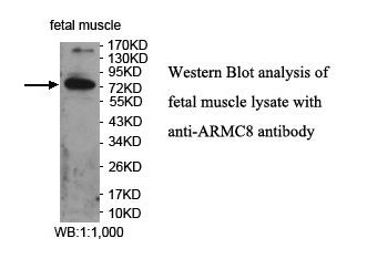 Anti-ARMC8 Antibody Anti-ARMC8 Antibody