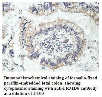 Anti-FRMD6 Antibody