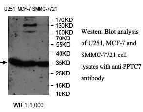 Anti-PPTC7 Antibody