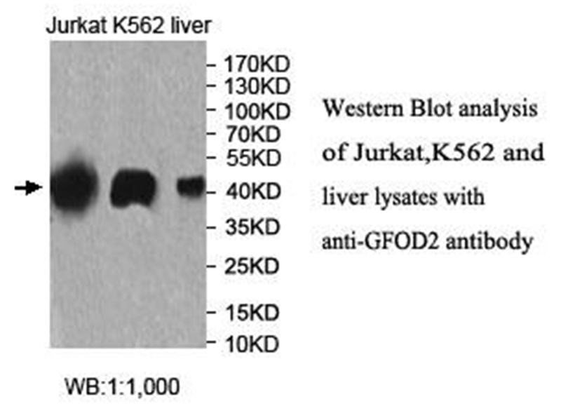 Anti-GFOD2 Antibody