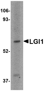 Anti-LGI1 Antibody