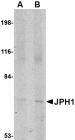 Anti-JPH1 Antibody