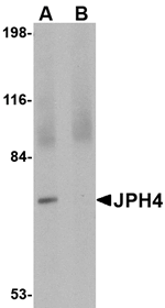 Anti-JPH4 Antibody