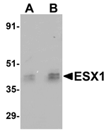 Anti-ESX1 Antibody