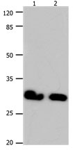 Anti-GJB6 Antibody